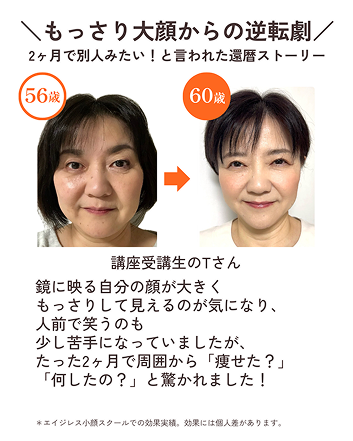 もっさり大顔からの逆転劇　2ヶ月で別人みたい！と言われた還暦ストーリー　56歳から60歳の変化　講座受講生のTさん　鏡に映る自分の顔が大きくもっさりして見えるのが気になり、人前で笑うのも少し苦手になっていましたが、たった2ヶ月で周囲から「痩せた?」
「何したの?」と驚かれました！＊エイジレス小顔スタールでの効果実績。効果には個人差があります。