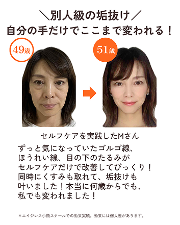 別人級の垢抜け　自分の手だけでここまで変われる！49歲から51歳での変化　セルフケアを実践したMさん　ずっと気になっていたゴルゴ線、ほうれい線、目の下のたるみがセルフケアだけで改善してびっくり！同時にくすみも取れて、垢抜けも叶いました！本当に何歳からでも、私でも変われました！＊エイジレス小顔スタールでの効果実績。効果には個人差があります。